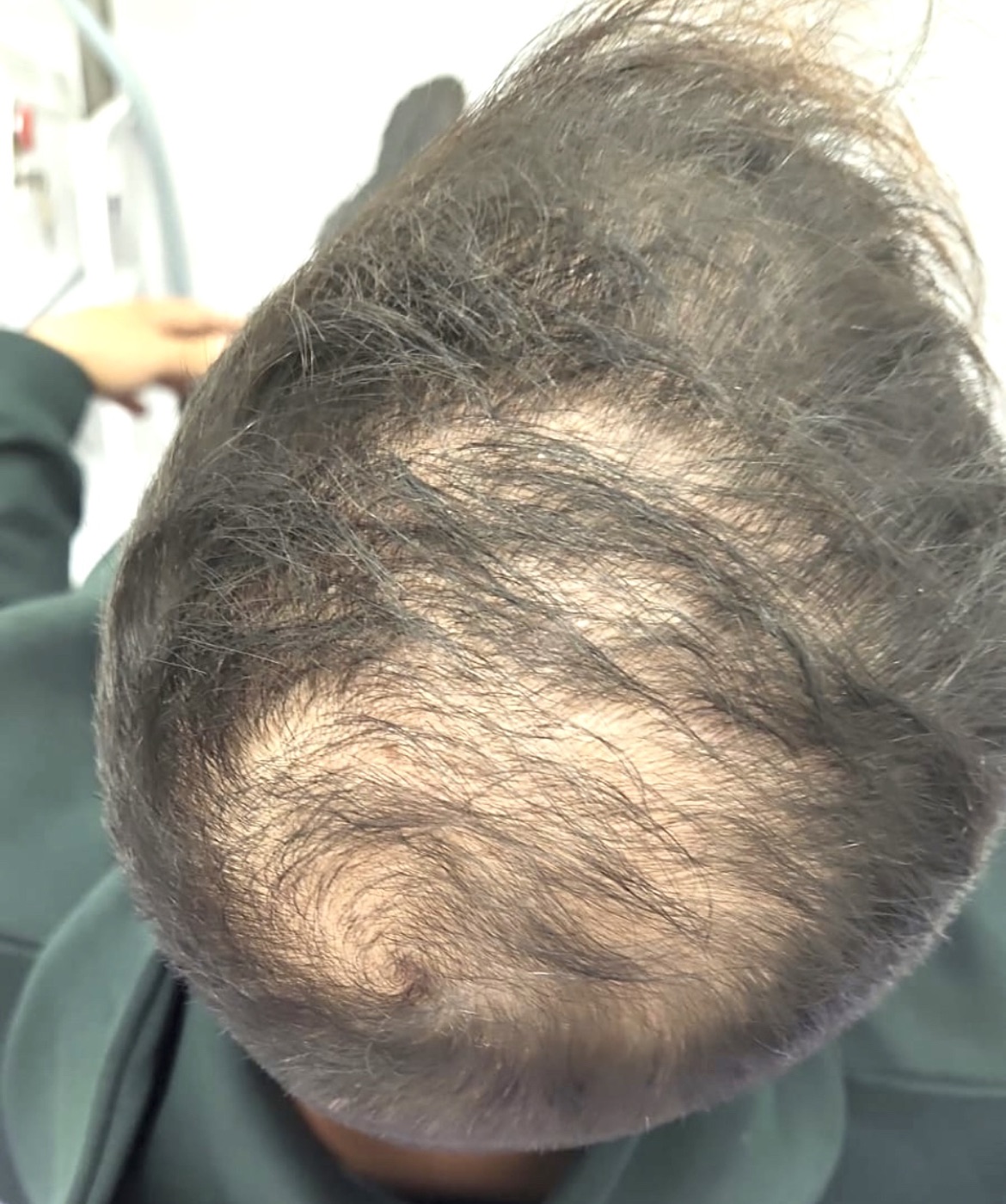 רועי - לפני